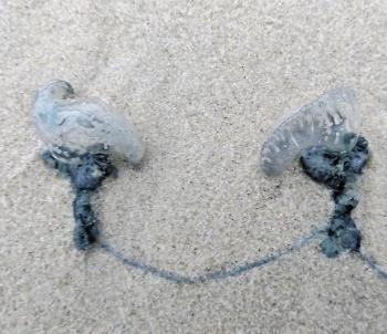 Bluebottles are everywhere and their sting can be very painful, especially for kids. Be careful where you walk.